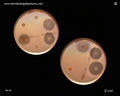 antibiotics resistant escherichia coli